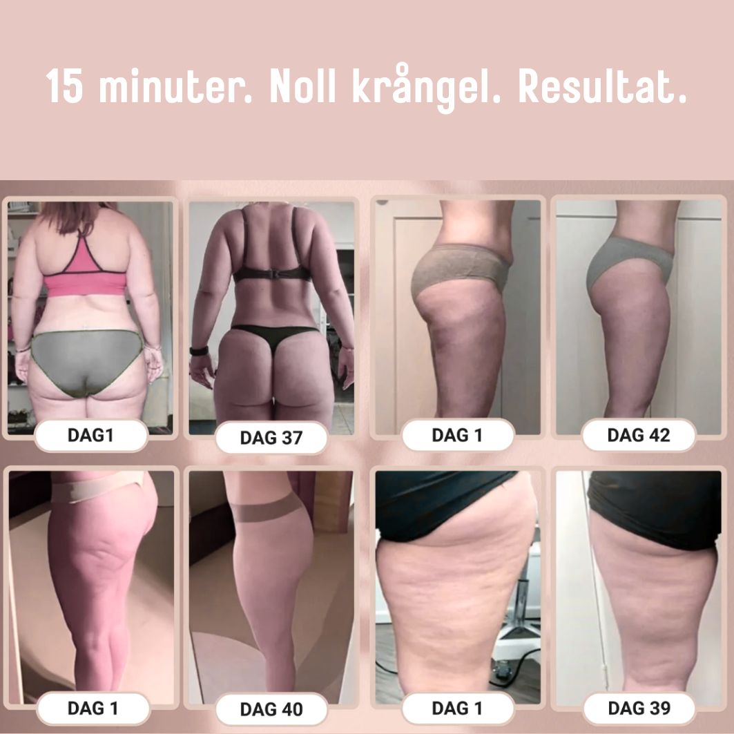 Wellnova Anti- Cellulite massager för slät hud